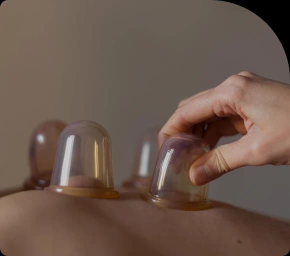 Cupping at Anura Spa, Thamel, Kathmandu